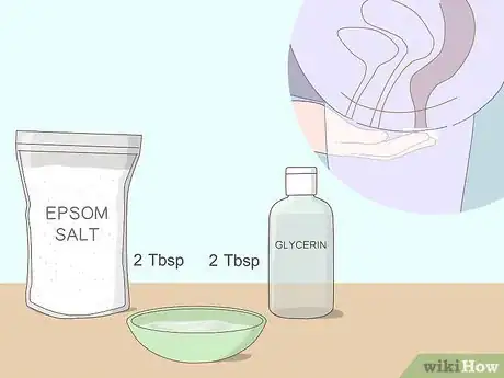 Imagem intitulada Get Rid of Hemorrhoids Fast Step 7