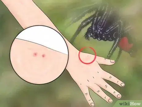 Imagem intitulada Identify a Spider Bite Step 1
