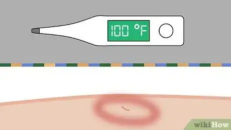 Imagem intitulada Remove a Tick Step 16