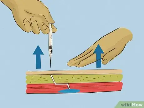Imagem intitulada Give an Intramuscular Injection Step 18