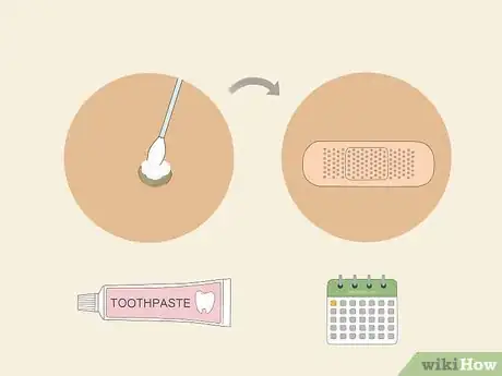 Imagem intitulada Get Rid of Warts Step 19