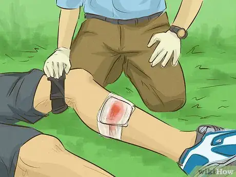 Imagem intitulada Stop Bleeding Step 22