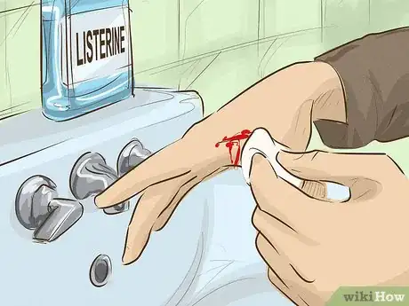 Imagem intitulada Stop Bleeding Step 10