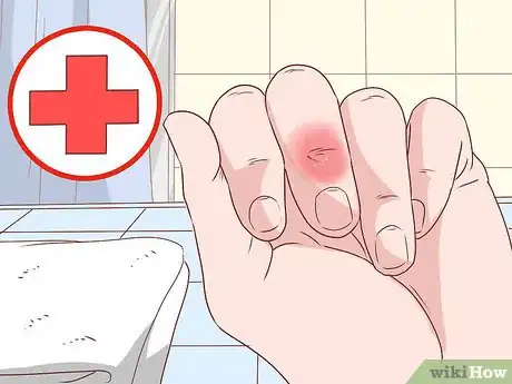 Imagem intitulada Remove a Splinter Step 2