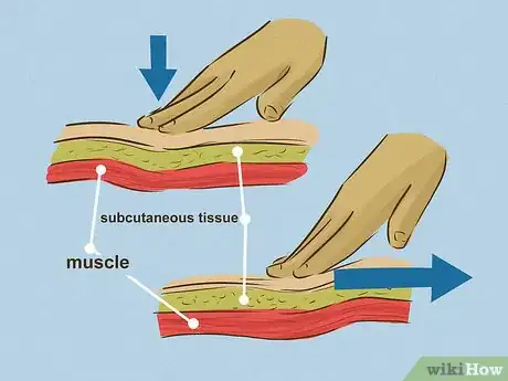 Imagem intitulada Give an Intramuscular Injection Step 15