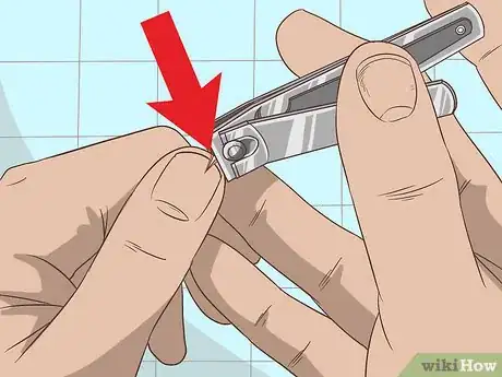 Imagem intitulada Remove a Deep Splinter Step 2