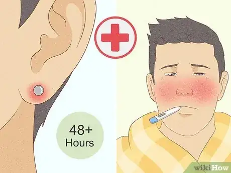 Imagem intitulada Treat Infected Piercings Step 7