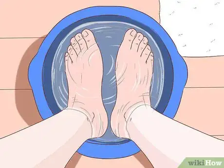 Imagem intitulada Get Rid of Calluses on Feet Step 1