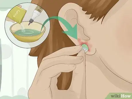 Imagem intitulada Clean an Infected Ear Piercing Step 3