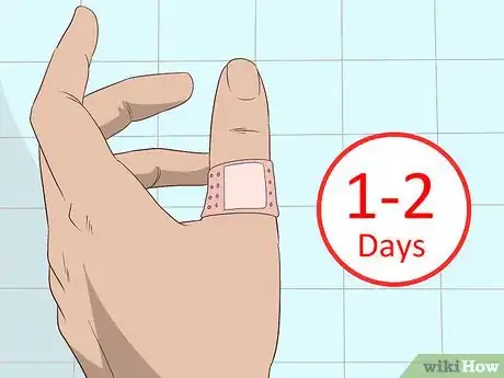 Imagem intitulada Remove a Deep Splinter Step 9