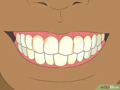 Imagem intitulada Fix Nicotine Stained Teeth Step 11