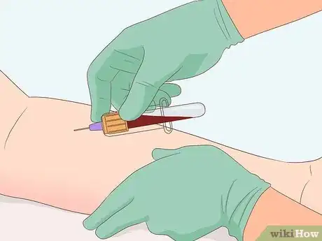 Imagem intitulada Lower CPK Levels Naturally Step 14