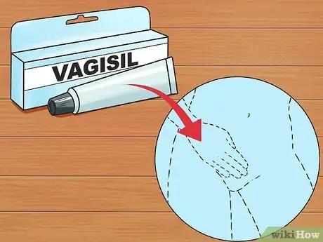 Imagem intitulada Use Vagisil Step 2