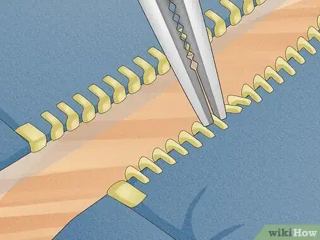 Imagem intitulada Fix a Separated Zipper Step 2