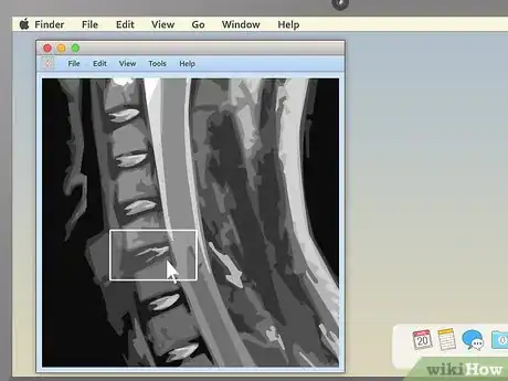 Imagem intitulada Read an MRI Step 11