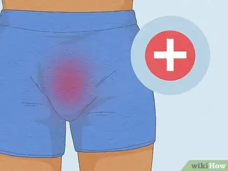 Imagem intitulada Cure Balanitis Step 8
