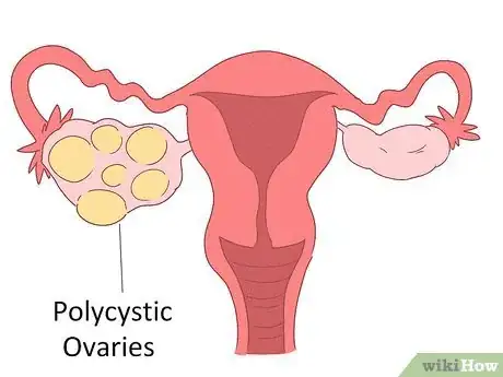 Imagem intitulada Lower Testosterone Levels Step 13