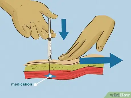 Imagem intitulada Give an Intramuscular Injection Step 17