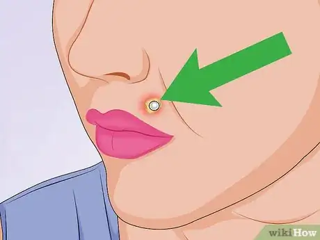 Imagem intitulada Tell if a Piercing Is Infected Step 5
