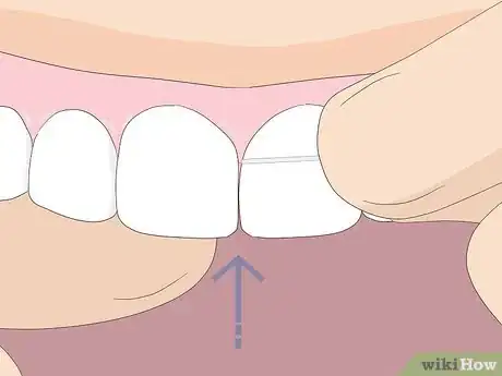 Imagem intitulada Floss Step 5