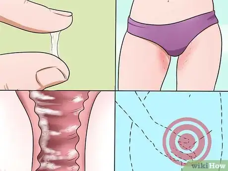 Imagem intitulada Stop Vaginal Itching Step 5