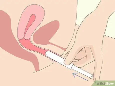 Imagem intitulada Use a Tampon Step 1