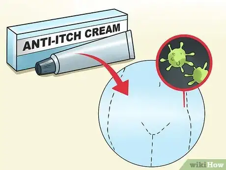 Imagem intitulada Stop Vaginal Itching Step 4