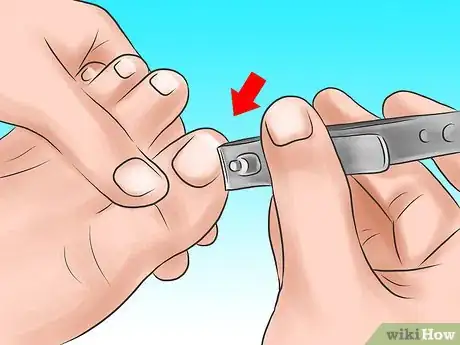 Imagem intitulada Clean Toe Nails Step 4