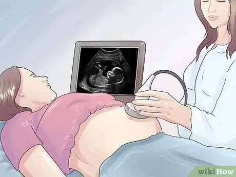 Imagem intitulada Increase Amniotic Fluid Step 16