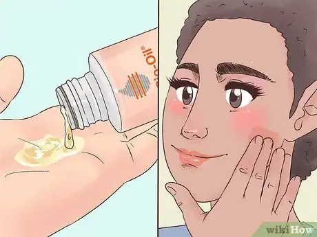 Imagem intitulada Use Bio Oil Step 14