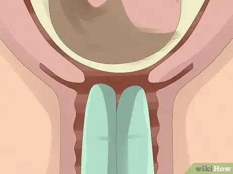 Imagem intitulada Induce Labor Naturally Step 5