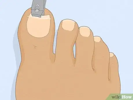 Imagem intitulada Have Pretty Toenails Step 5