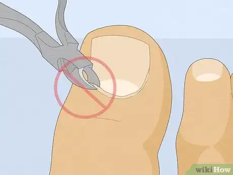 Imagem intitulada Have Pretty Toenails Step 7