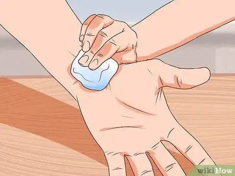 Imagem intitulada Apply Cold Therapy Step 7
