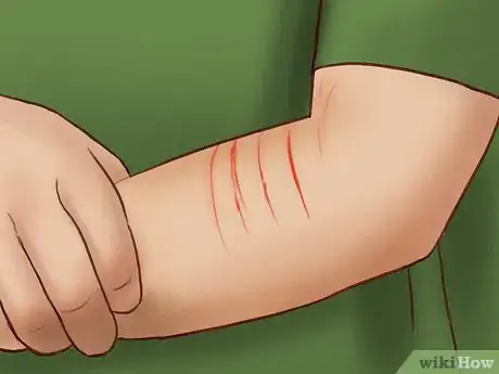 Imagem intitulada Deal With a Cat Scratch Step 3