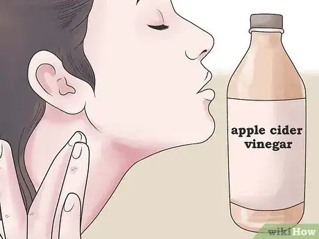 Imagem intitulada Treat an Infected Sebaceous Cyst Step 9