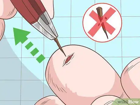 Imagem intitulada Remove a Deep Splinter Step 13