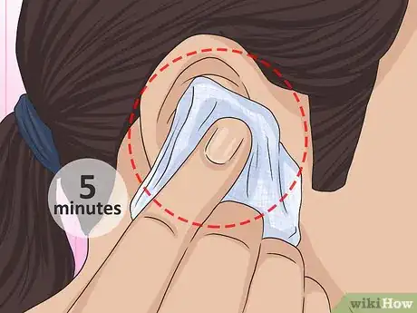 Imagem intitulada Clean a Daith Piercing Step 4