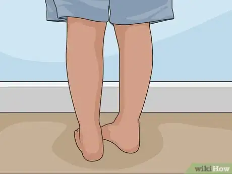 Imagem intitulada Remove Scars on Legs Step 01